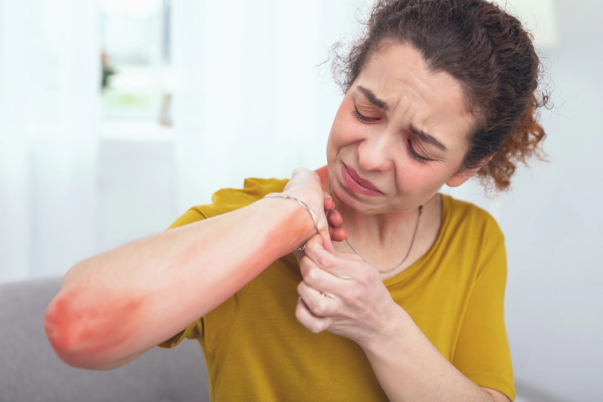 Women Allergic